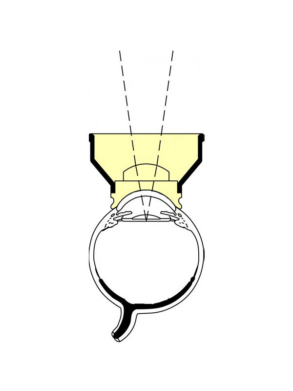 OAYA_2 Abraham Capsulotomy Laser Lens