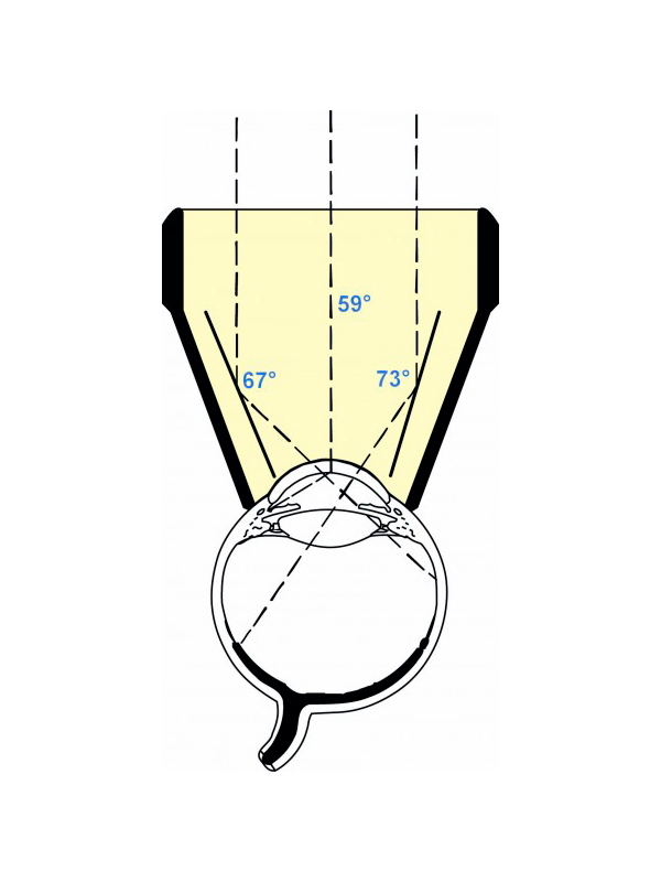 OG3MA_2 Three Mirror Universal Gonio Laser Lens