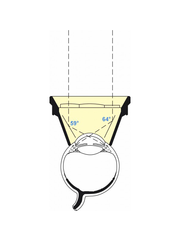 ORTA_1 Ritch Trabeculoplasty Laser Lans